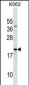 SUB1 Antibody(Center)