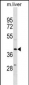 ZFP36L1 Antibody(N-term)