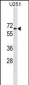 GGT1 Antibody (N-term)