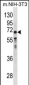 GGT1 Antibody (N-term)