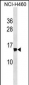 NDUFS6 Antibody (Center)