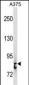 STAT3 Antibody (C-term)