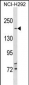 TSC2 Antibody (N-term)