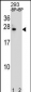 BCL2 Antibody (Center)