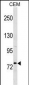 MTHFR Antibody (Center)