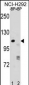 PARP1 Antibody (N-term)