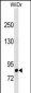 DPP4 Antibody (N-term)