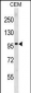 PGR Antibody (Center)