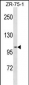 PGR Antibody (C-term)