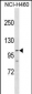 PARP1 Antibody (Center)