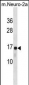 RPL22 Antibody(C-term)
