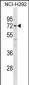 MMP14 Antibody (C-term)