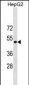 ST6GAL1 Antibody (Center)