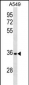 CD5L Antibody (N-term)