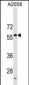 USP14 Antibody (C-term)