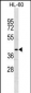 NR2E1 Antibody (Center)