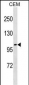 UNC5C Antibody (N-term)