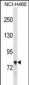 AMPH Antibody (Center)