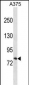 RXFP1 Antibody (C-term)