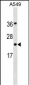 PDCD6 Antibody (N-term)