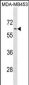 ADRA1B Antibody (C-term)