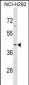 SERPINB9 Antibody (Center)