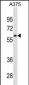 ZNF394 Antibody (Center)