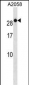 RAB7B Antibody (C-term)