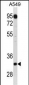 C1QTNF2 Antibody (C-term)