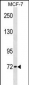 CPT2 Antibody (Center)