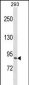 NCBP1 Antibody (C-term)