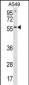 ETV5 Antibody (N-term)