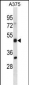 ADRM1 Antibody (C-term)