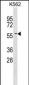 ERF Antibody (C-term)