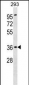 ATP6AP2 Antibody (Center)