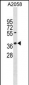 AVEN Antibody (N-term)