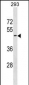 GPR151 Antibody (C-term)