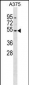 DUSP10 Antibody (Center)