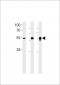 DMRTA2 Antibody (C-term)
