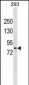 DCLK2 Antibody (N-term)