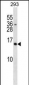 SH2D1A Antibody (C-term)