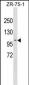 PDCD6IP Antibody (Center)