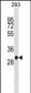 SDHB Antibody (C-term)