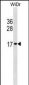HIST2H2BE Antibody (N-term)