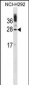 CIB1 Antibody (C-term)