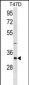 HAVCR2 Antibody (Center)