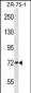 SCNN1B Antibody (Center)