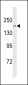 TTBK1 Antibody (Center)