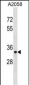 ACP5 Antibody (N-term)