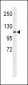 CHSY3 Antibody (Center)